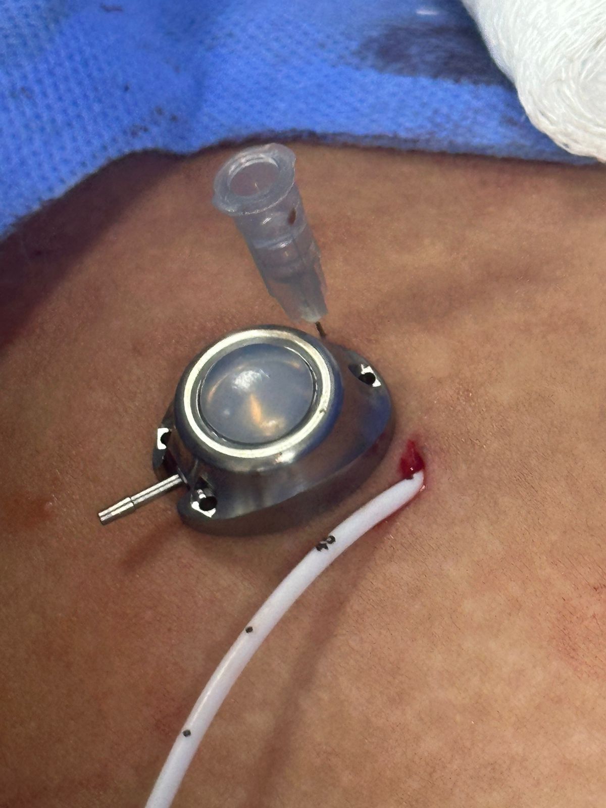 Odoo • Imagen y texto